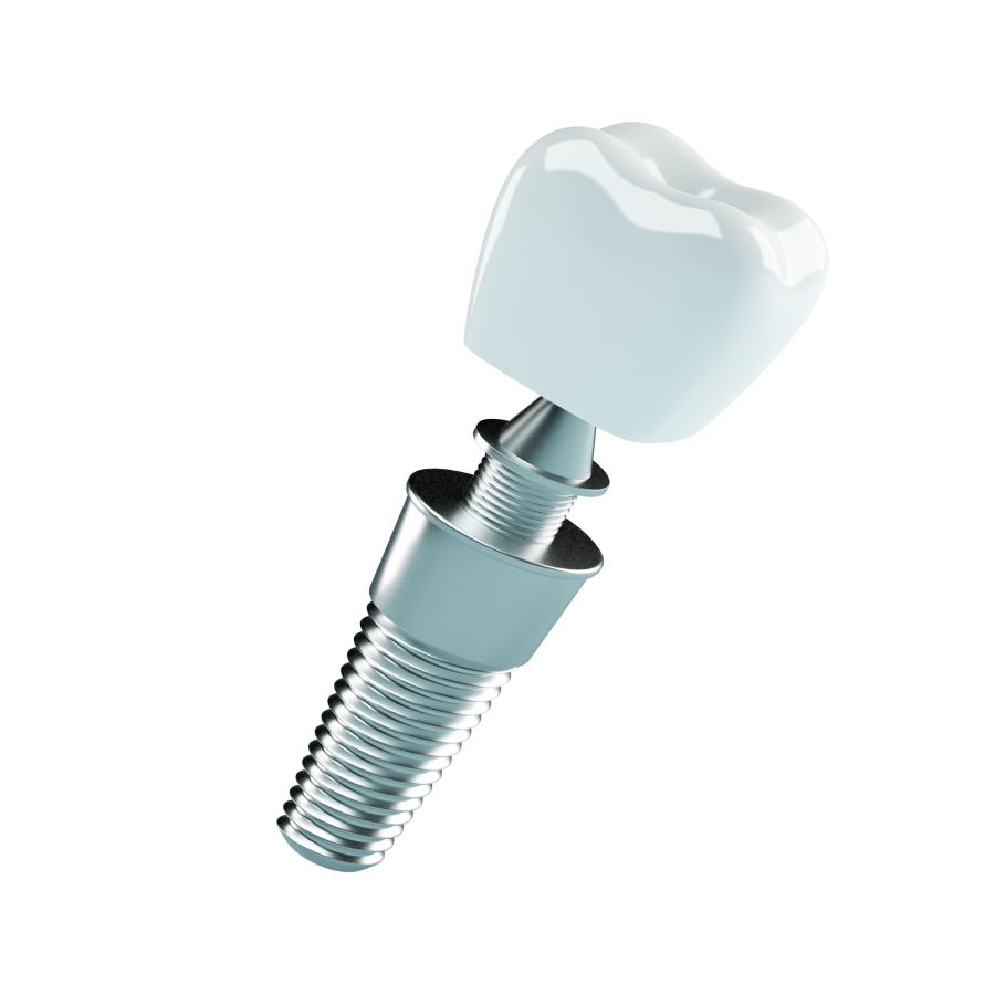 Dental Implant